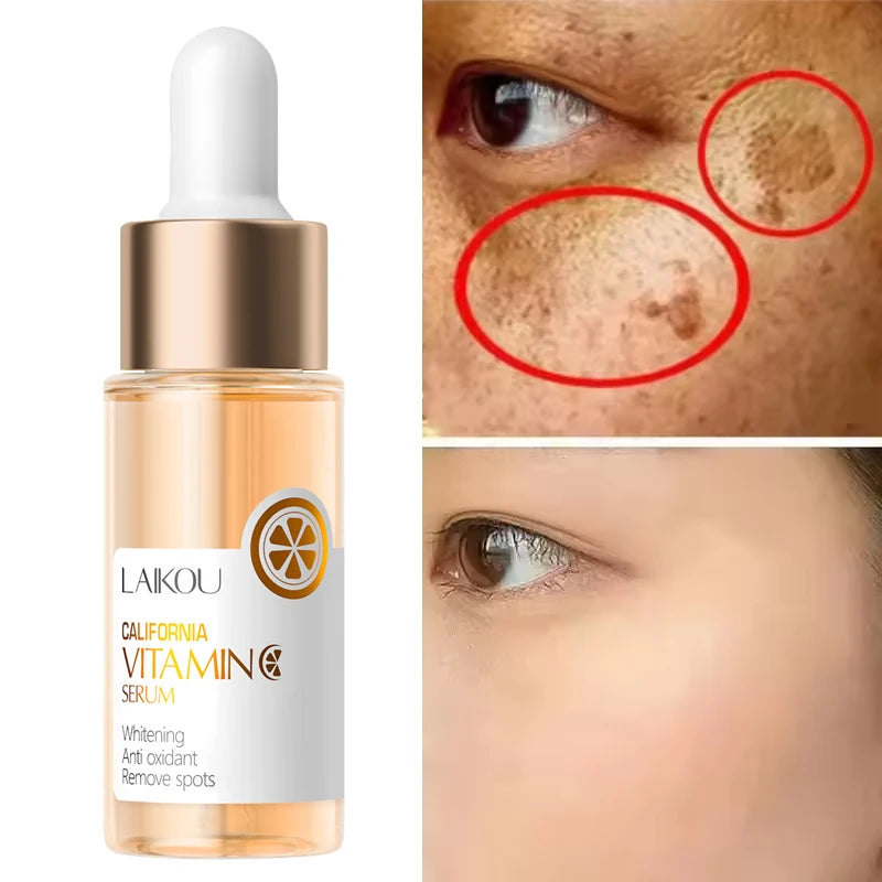 Vitamin C Whitening Serum Freckle Remove Essence Fade Pigmentation Melasma Dark Spots Corrector Repair Serum Korean Skin Care Peaceful Pleasures Health and Wellness 1pcs-17ml