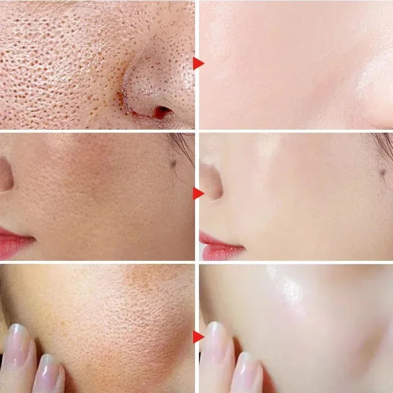 Acidity Pore Shrink Face Serum Remove Blackhead Acne Spot Oil Control Moisturizing Repair Nourish Pores Firming Smooth Skin Care Peaceful Pleasures Health and Wellness