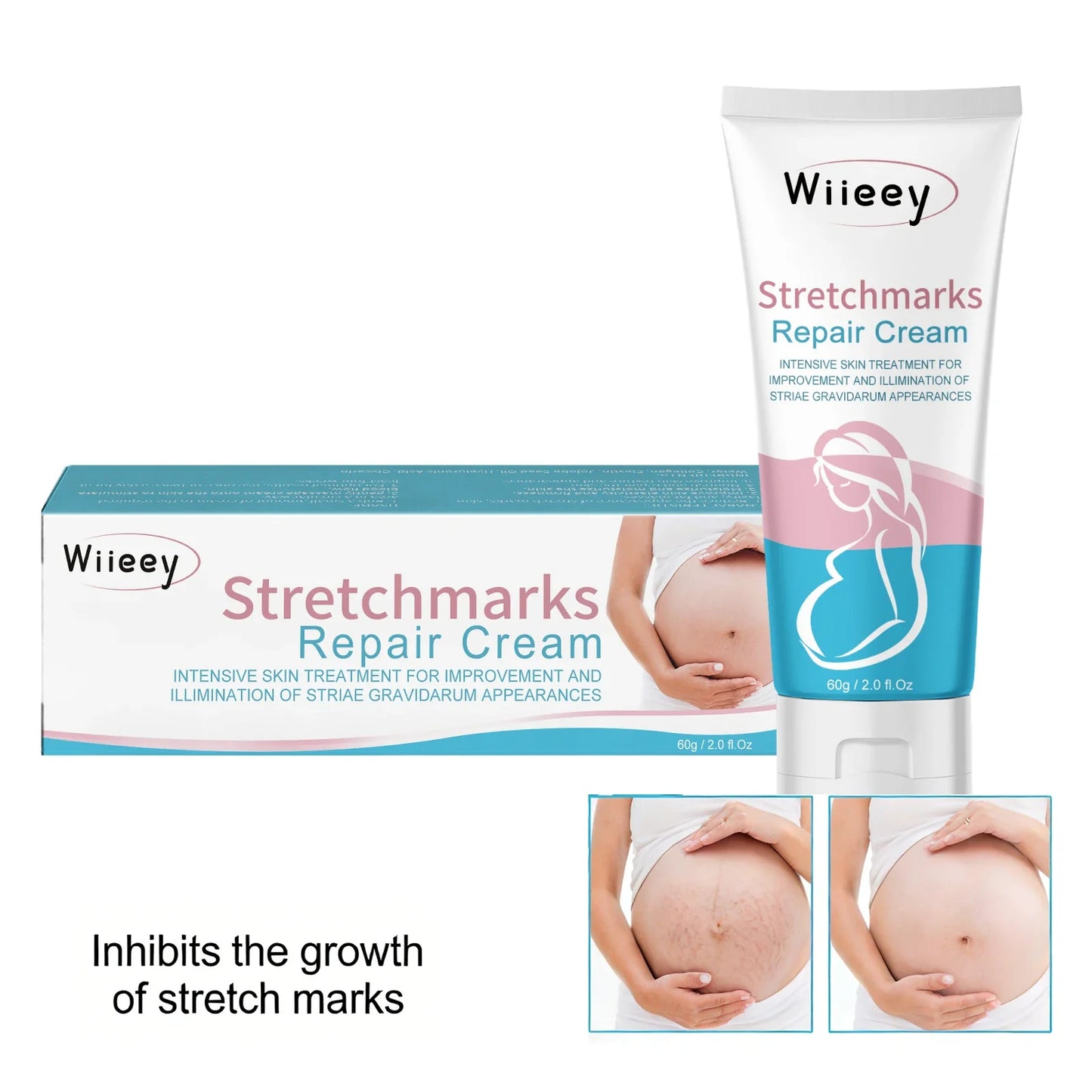 Wiieey Stretch Mark Cream – Firm, Hydrate & Restore Skin