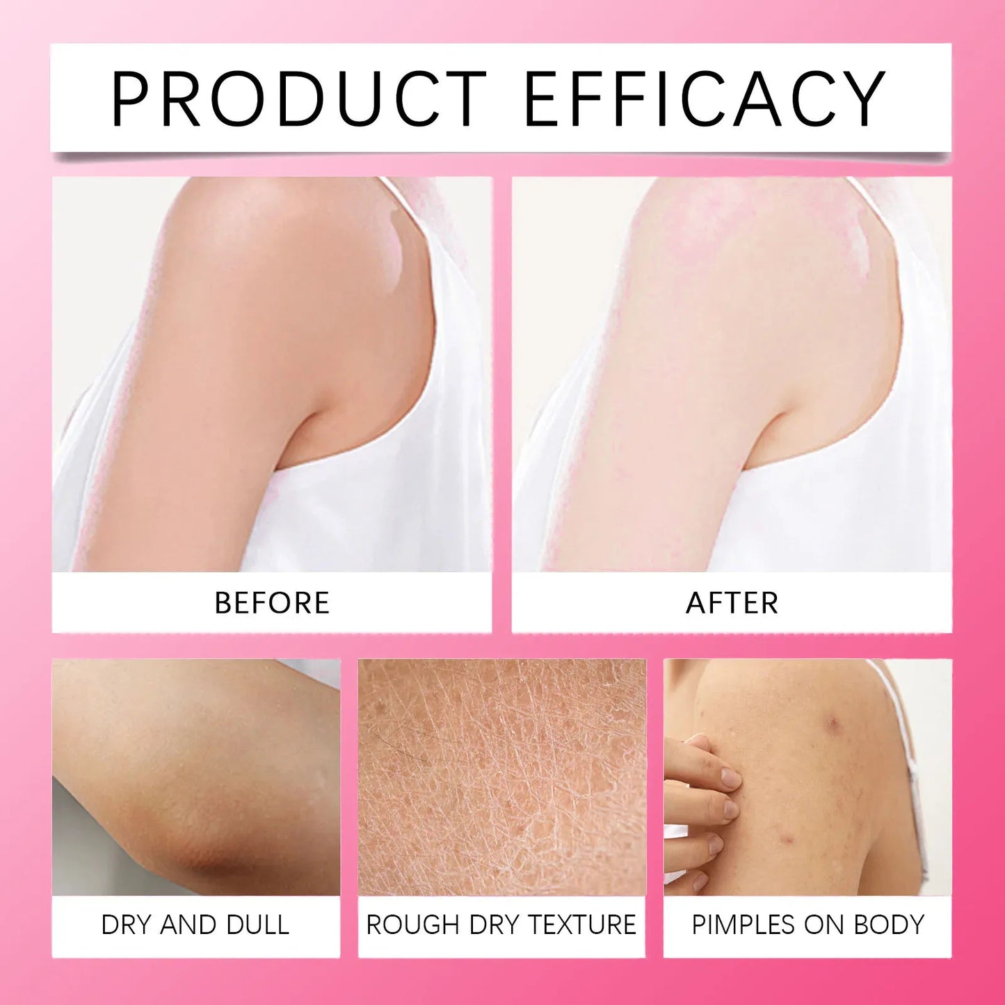 SADOER Brightening Body Cream – Underarm, Thigh & Intimate Skin