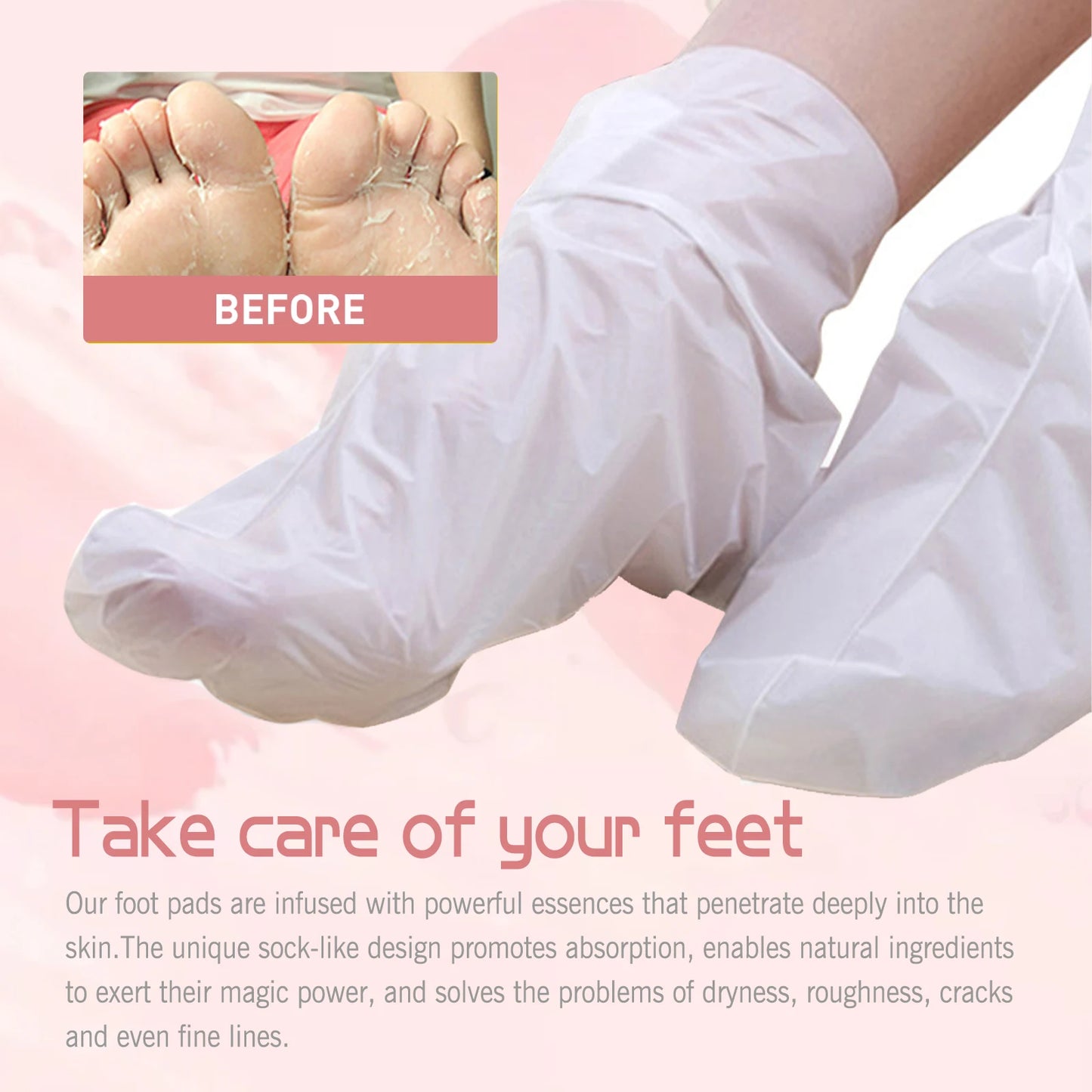 Peach Exfoliating Foot Mask Booties | Dead Skin Removal Socks