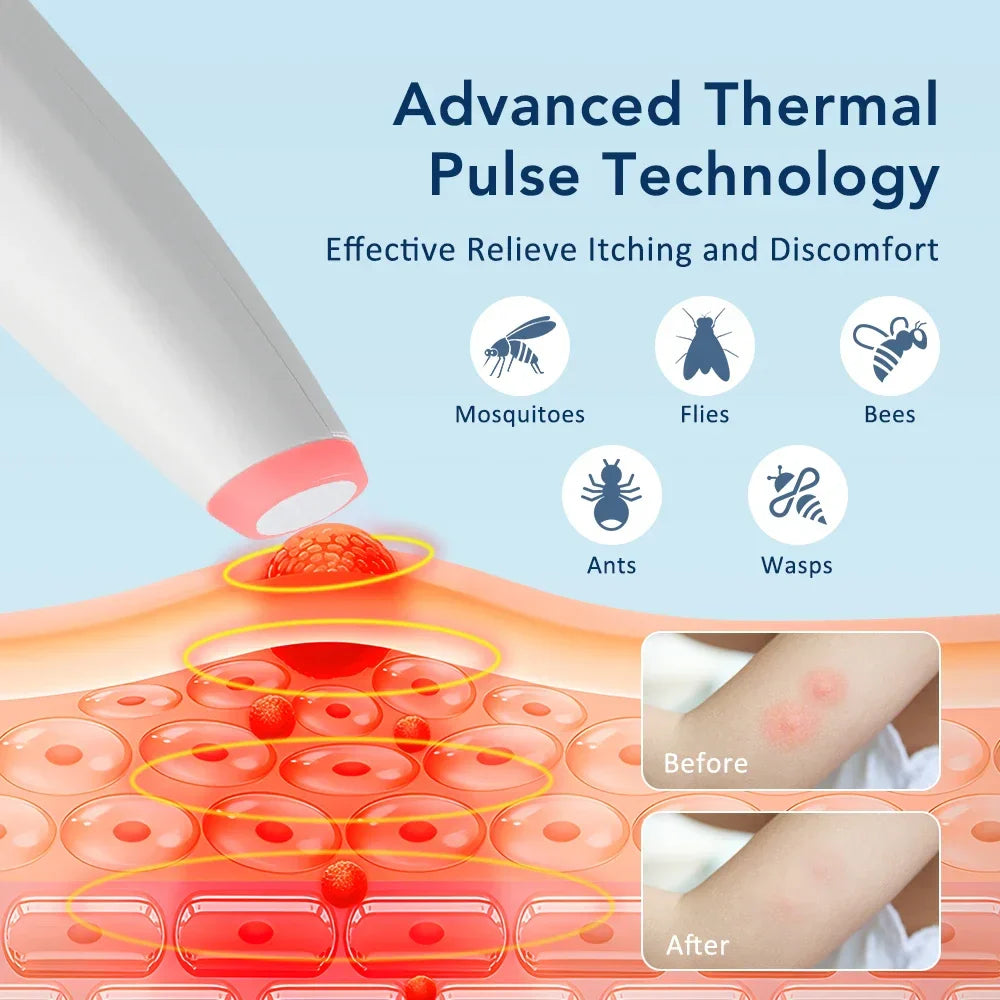 Rechargeable Insect Bite Heat Pen – 4 Temp Settings