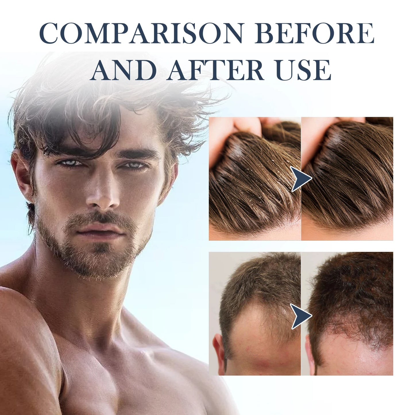 East Moon Collagen Shampoo for Men – Dandruff & Oil Control