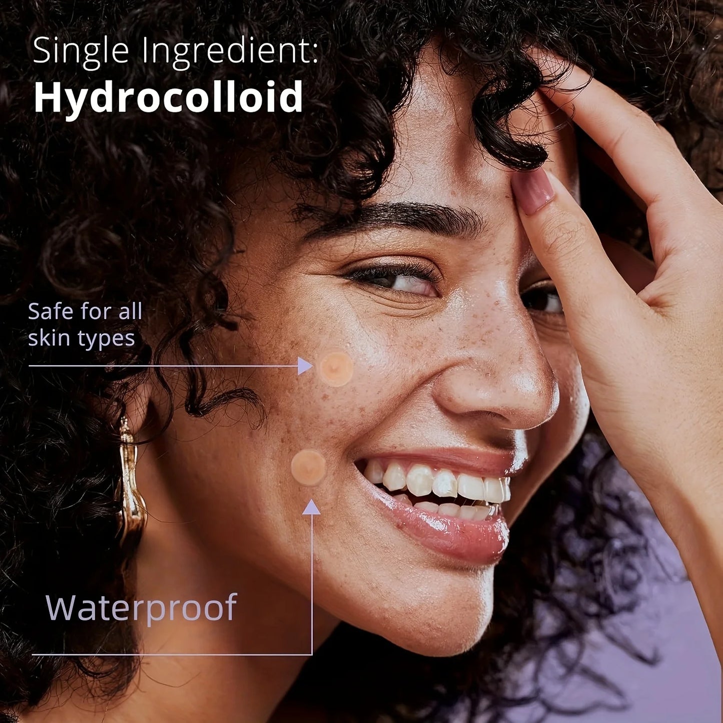 Hydrocolloid Acne Patches – Invisible, Waterproof, All Skin Types