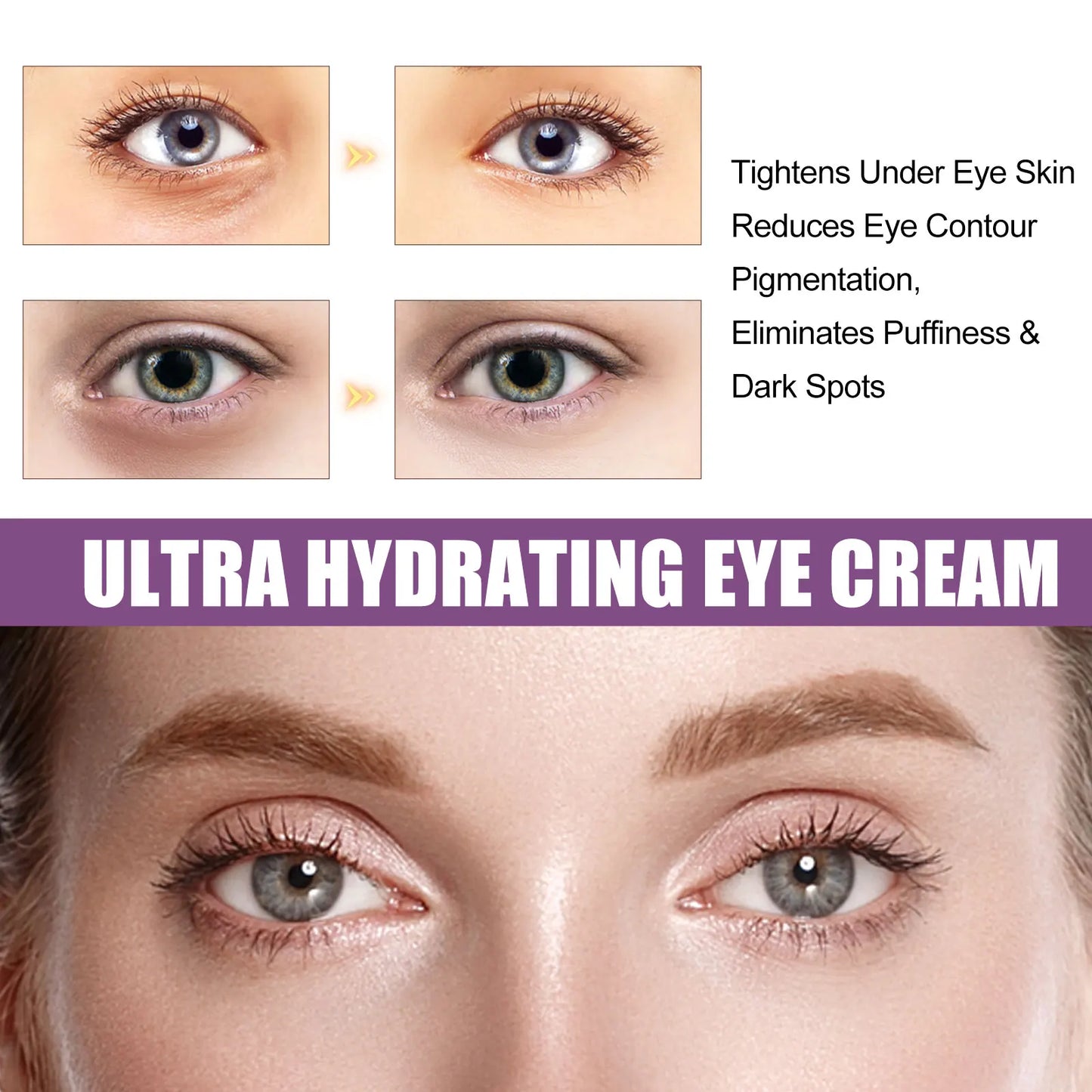 Ultra Hydrating Eye Cream – Dark Circles, Puffiness & Wrinkles