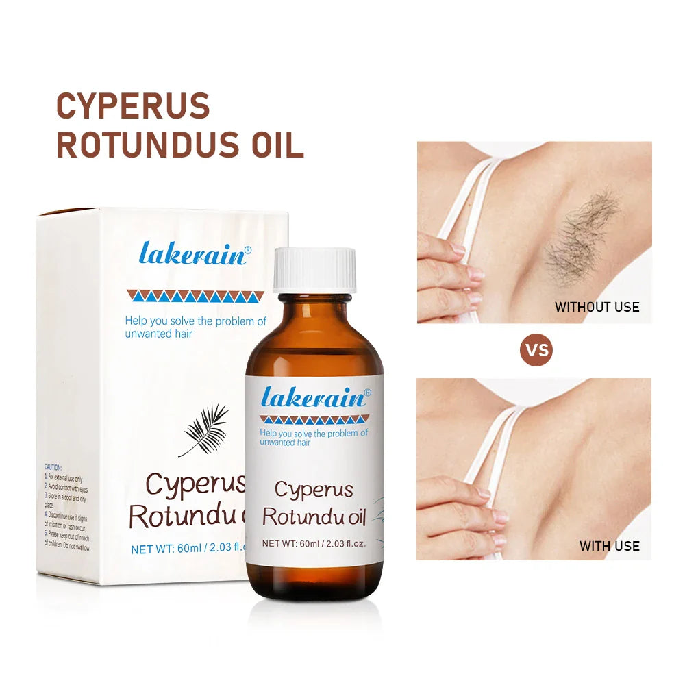 Cyperus Rotundus Hair Growth Inhibitor Oil – 60ml Body Serum