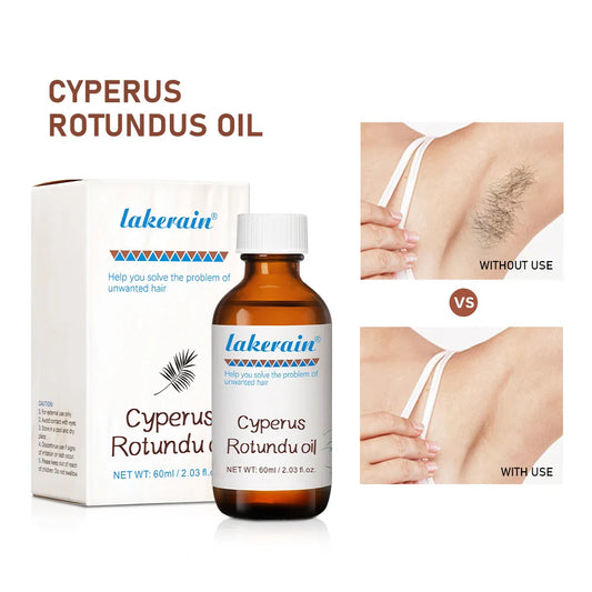 Cyperus Rotundus Hair Growth Inhibitor Oil – 60ml Body Serum Hair Growth Inhibitor Oil Oasis Select