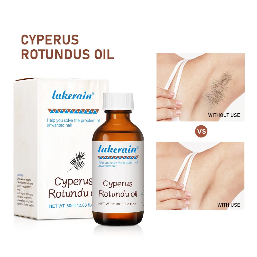 Semi-permanent Cyperus Rotundus Oil Hair Remover Armpit Legs Arms Hair Growth Inhibitor Beauty Skin Care Body Essential Oil Peaceful Pleasures Health and Wellness