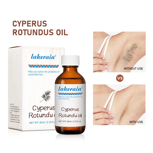 Semi-permanent Cyperus Rotundus Oil Hair Remover Armpit Legs Arms Hair Growth Inhibitor Beauty Skin Care Body Essential Oil Peaceful Pleasures Health and Wellness