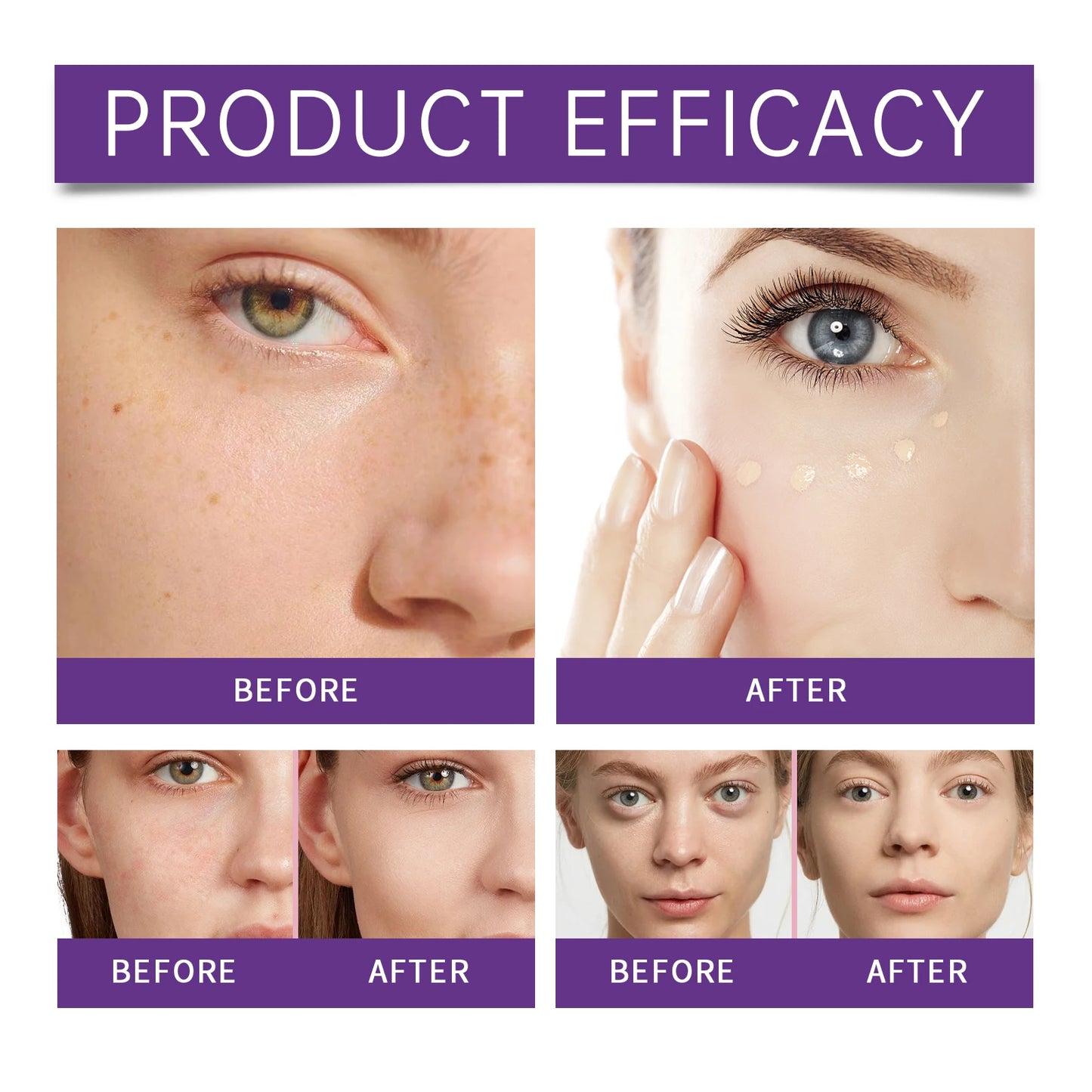 Hydrating Liquid Concealer – Full Coverage, Dark Circles & Blemish