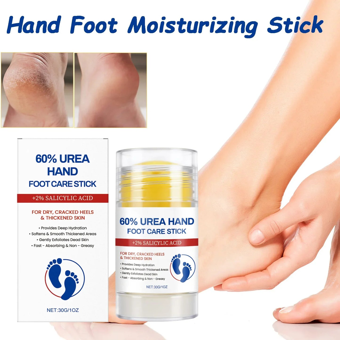 Hoygi Hand & Foot Moisturizing Stick – Anti-Crack Balm 30g