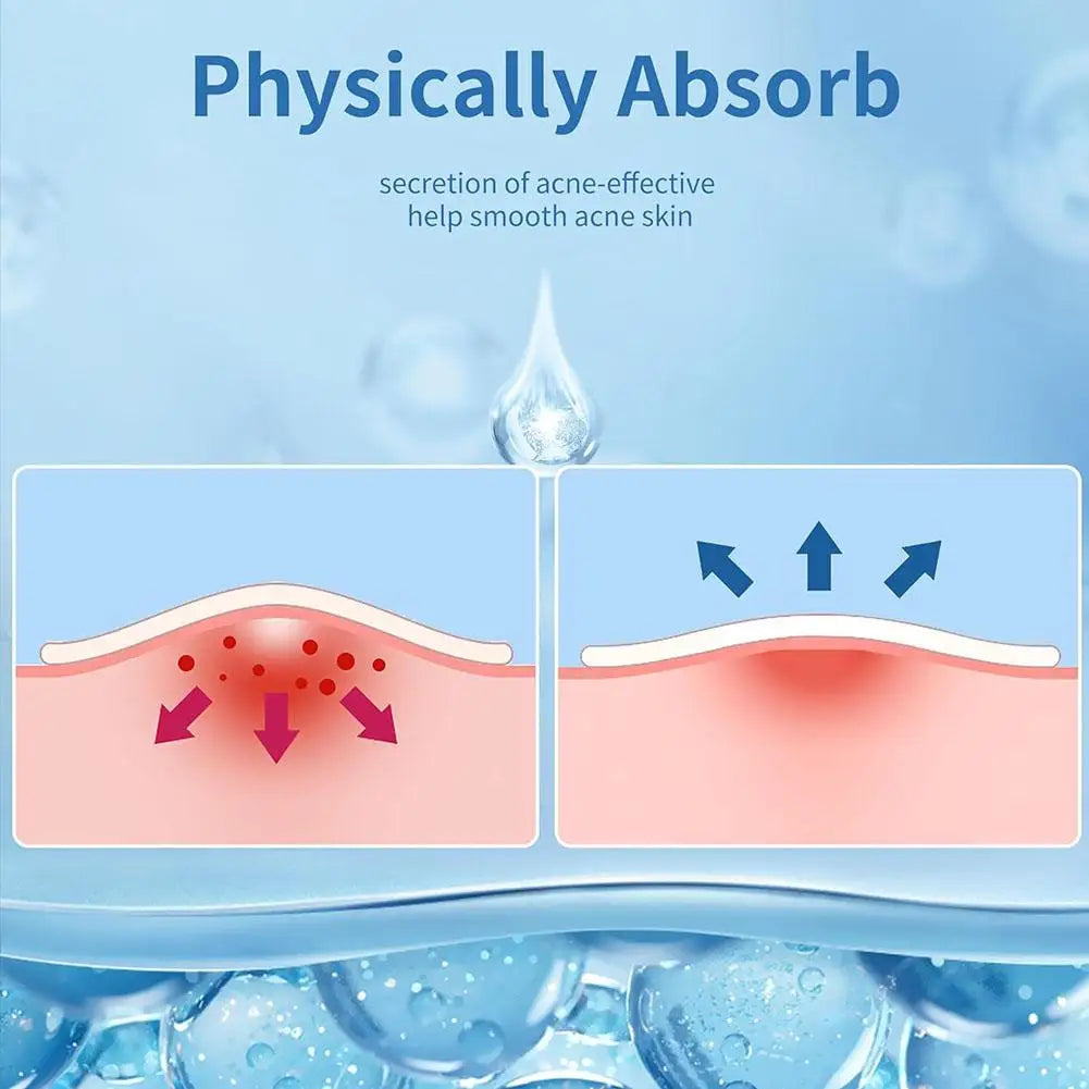 Salicylic Acid Pimple Patches – Invisible Spot Stickers