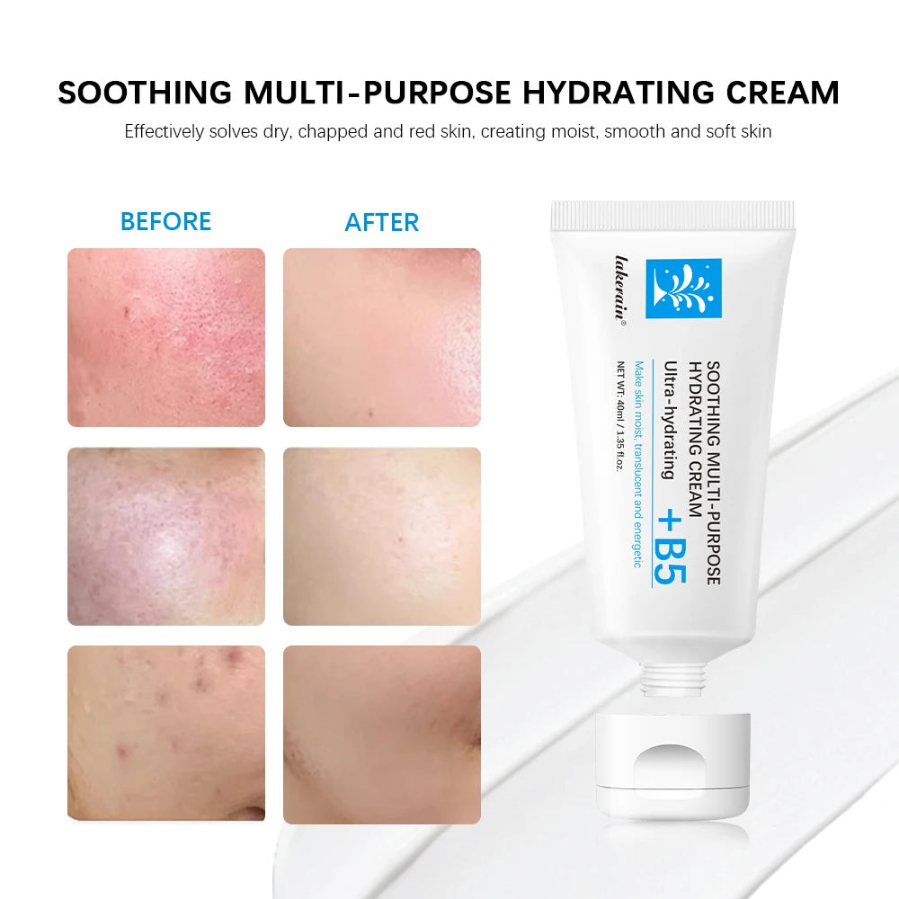 Soothing Multi-Purpose Hydrating Cream Reduces Redness Daily Helps Relieve Rough Cracked Skin Deep Skin Care Peaceful Pleasures Health and Wellness