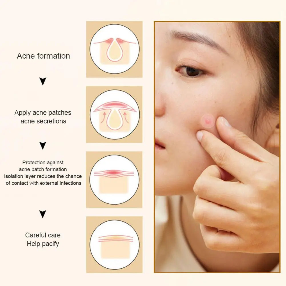 Colorful Star & Heart Shaped Acne Pimple Patches – Invisible Cute Acne Cover Stickers 40pcs Peaceful Pleasures Health and Wellness