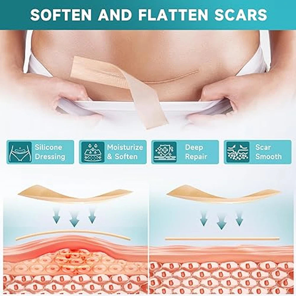 Silicone Scar Tape Roll – Keloid, Surgical & Acne Scar Sheets Silicone Scar Tape Peaceful Pleasures Health and Wellness