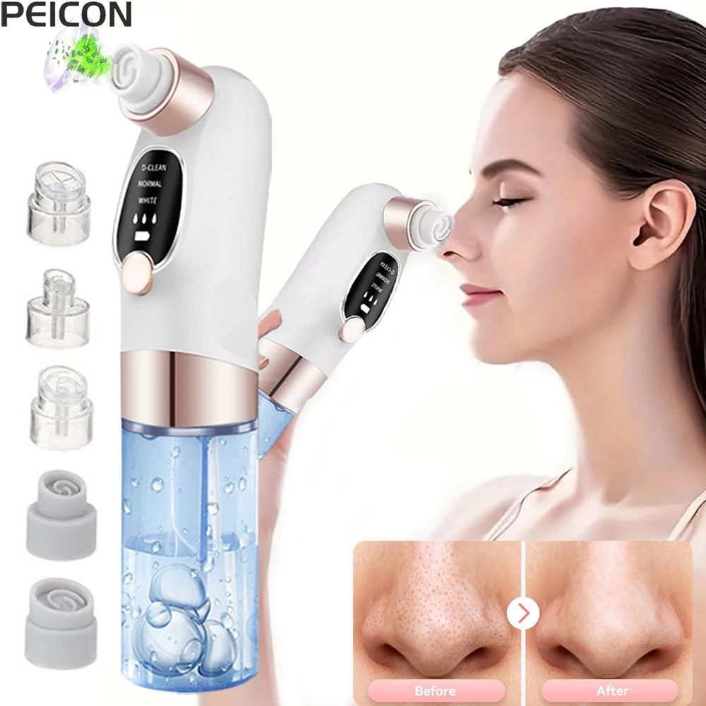 Blackhead Remover Black Dots Vacuum Cleaner Facial Pore Cleaner Deep Cleaning Black Dots Remover Pimple Acne Blackhead Removal Peaceful Pleasures Health and Wellness