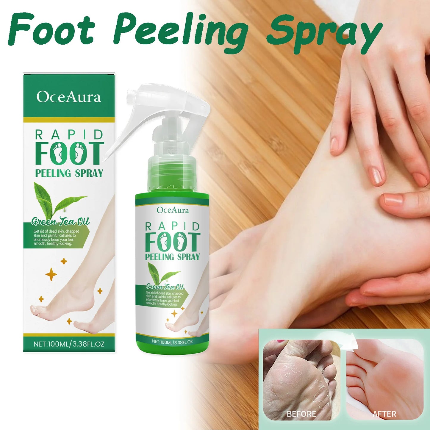 Foot Peeling Spray – Exfoliate & Heal Dry Cracked Heels