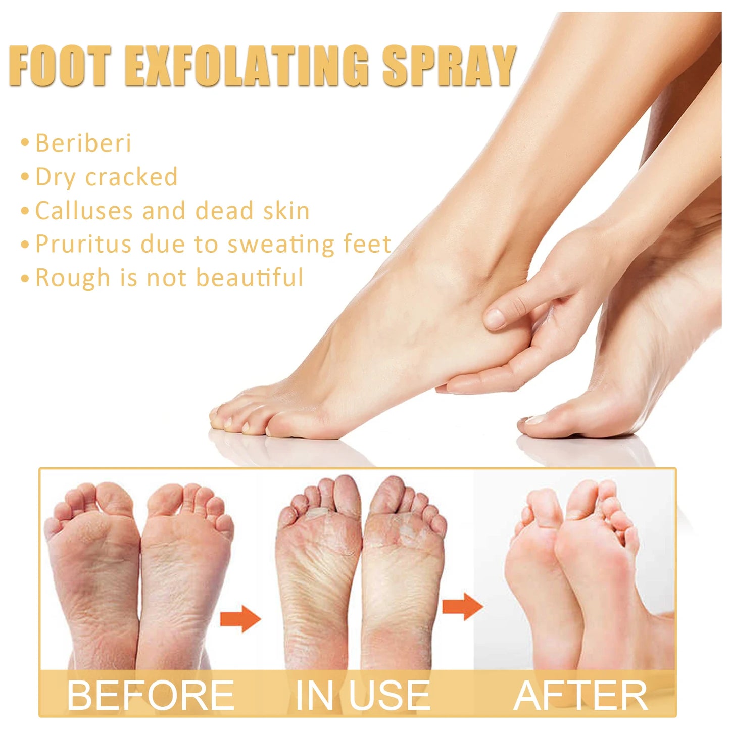 Ouhoe Foot Callus Remover Spray | 72H Moisture & Exfoliation