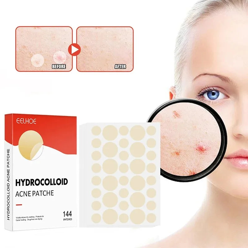 144pcs/set Face High-end Skin Care Pimple Acne Patches Professional Healing Absorbing Spot Sticker Covering for Covering Acne Peaceful Pleasures Health and Wellness