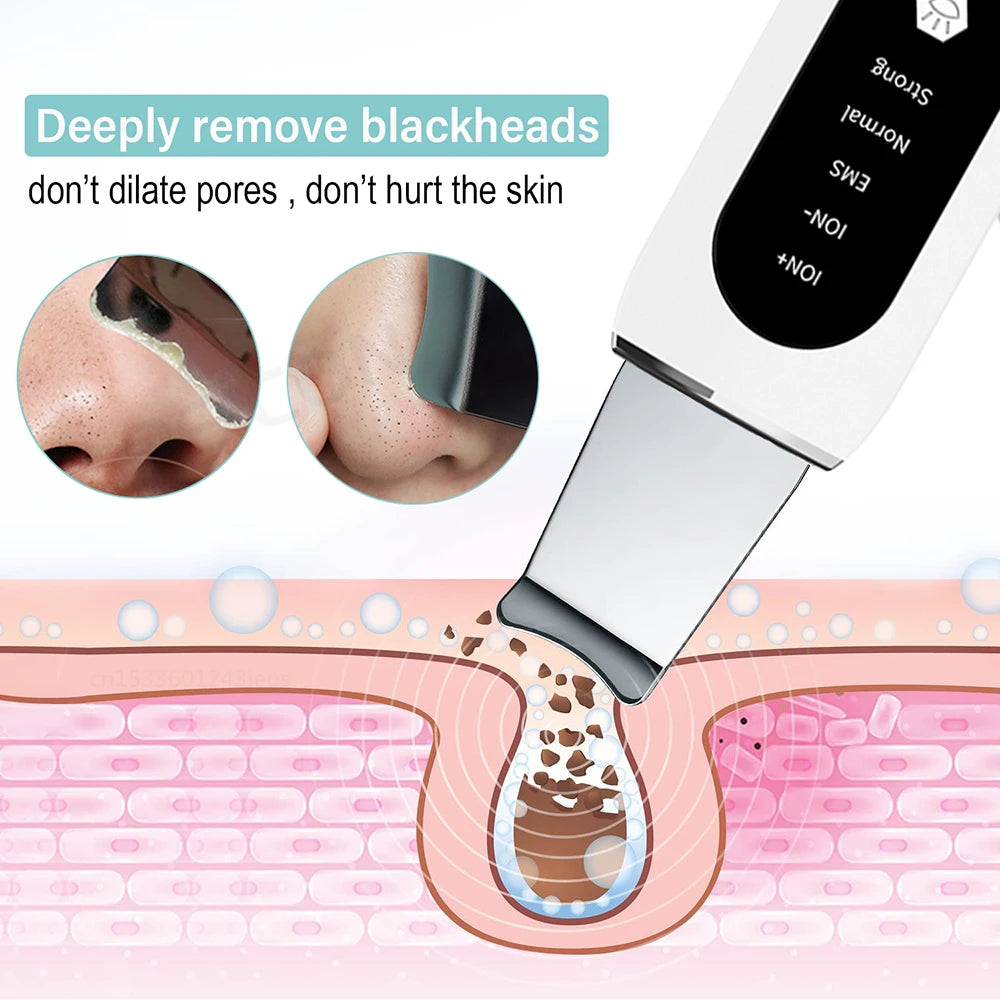 Ultrasonic Skin Scrubber Peeling Blackhead Remover Deep Face Cleaning Ultrasonic Ion Ance Pore Cleaner Facial Shovel Cleanser Peaceful Pleasures Health and Wellness
