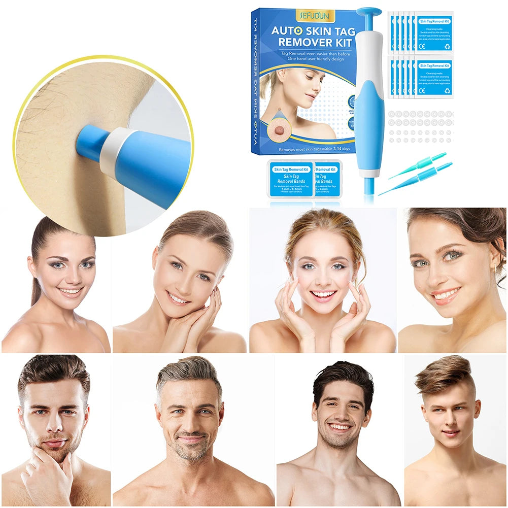 2-in-1 Skin Tag Remover Kit – Auto Micro Device Peaceful Pleasures Health and Wellness