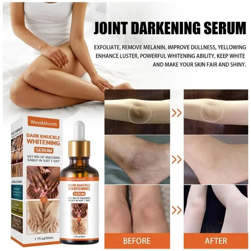 LGRAMER Whitening Essence for Dark Knuckles, Elbows & Knees