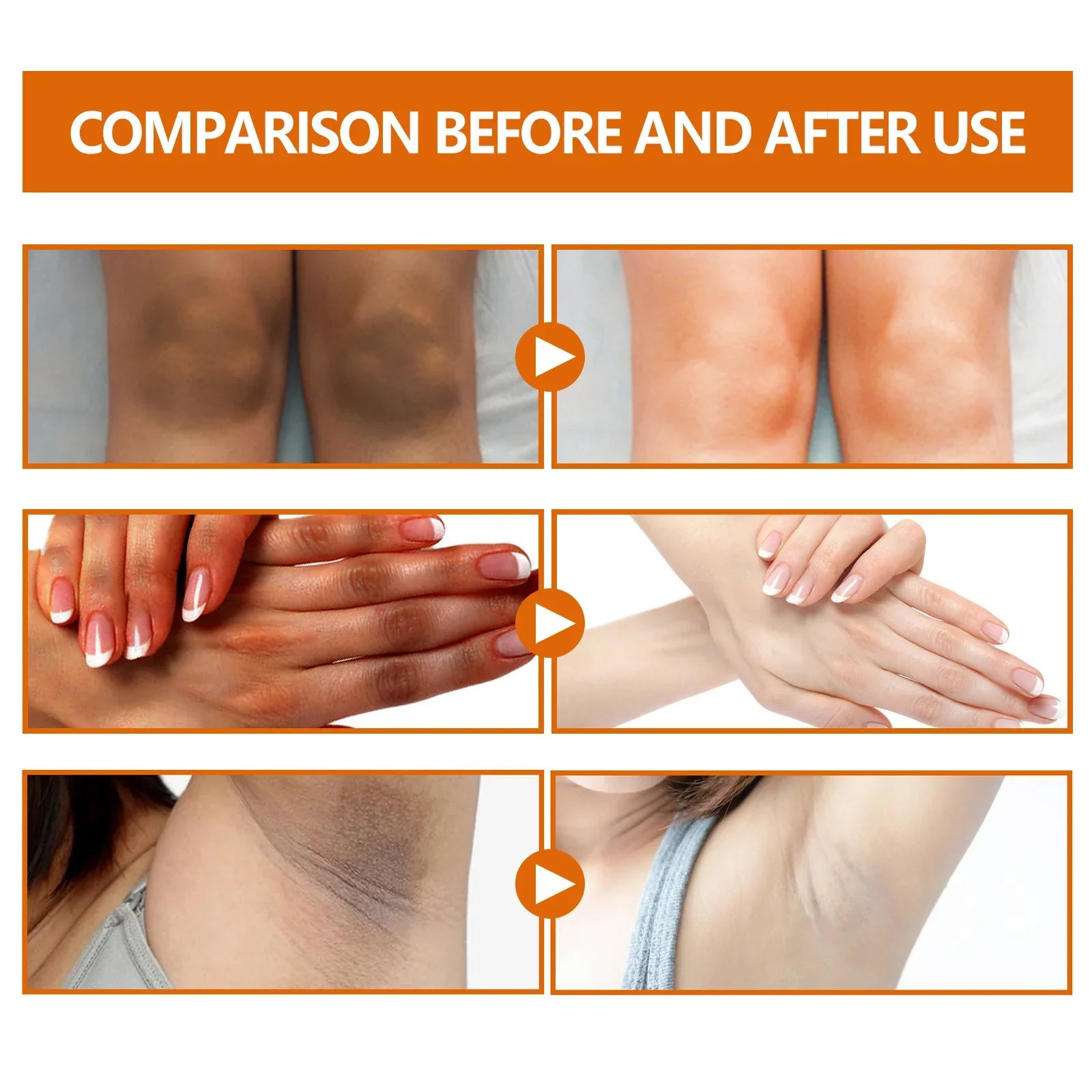 Dark Knuckles Whitening Serum Dark Knees Elbow Lightening Pigmentation Corrector Hand Knuckle Glow Intense Stains Remover Serum Peaceful Pleasures Health and Wellness