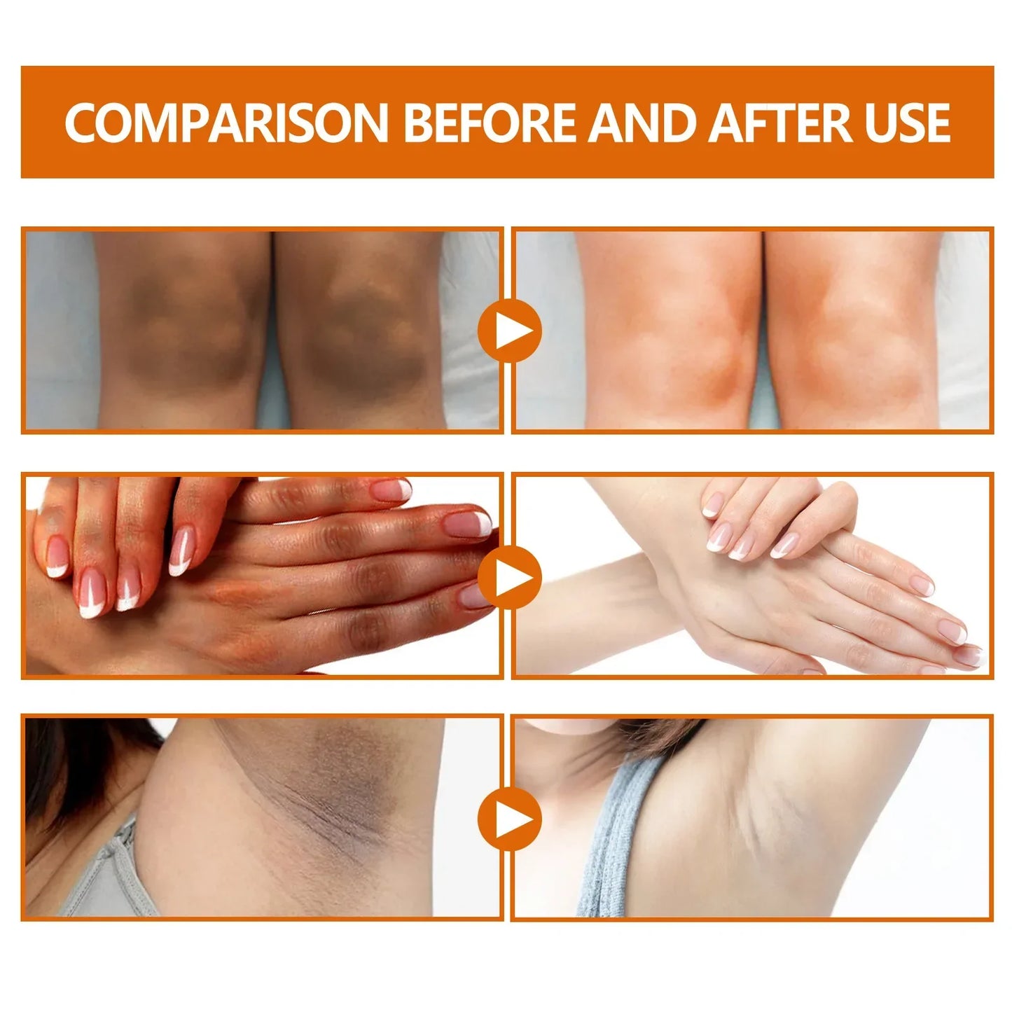 Dark Knuckles Whitening Serum Dark Knees Elbow Lightening Pigmentation Corrector Hand Knuckle Glow Intense Stains Remover Serum Peaceful Pleasures Health and Wellness