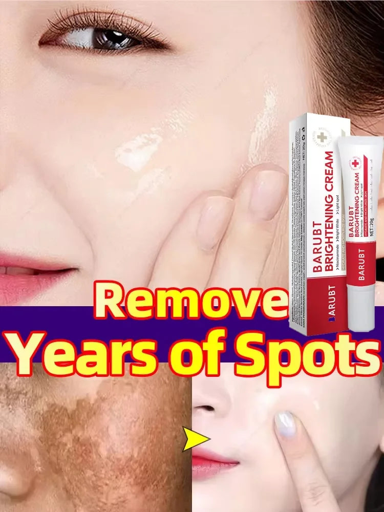 Effective Whitening Freckles Face Cream Removal Melasma Dark Spots Fade Melanin Pigmentation Corrector Brighten Repair Skin Care Peaceful Pleasures Health and Wellness 20g