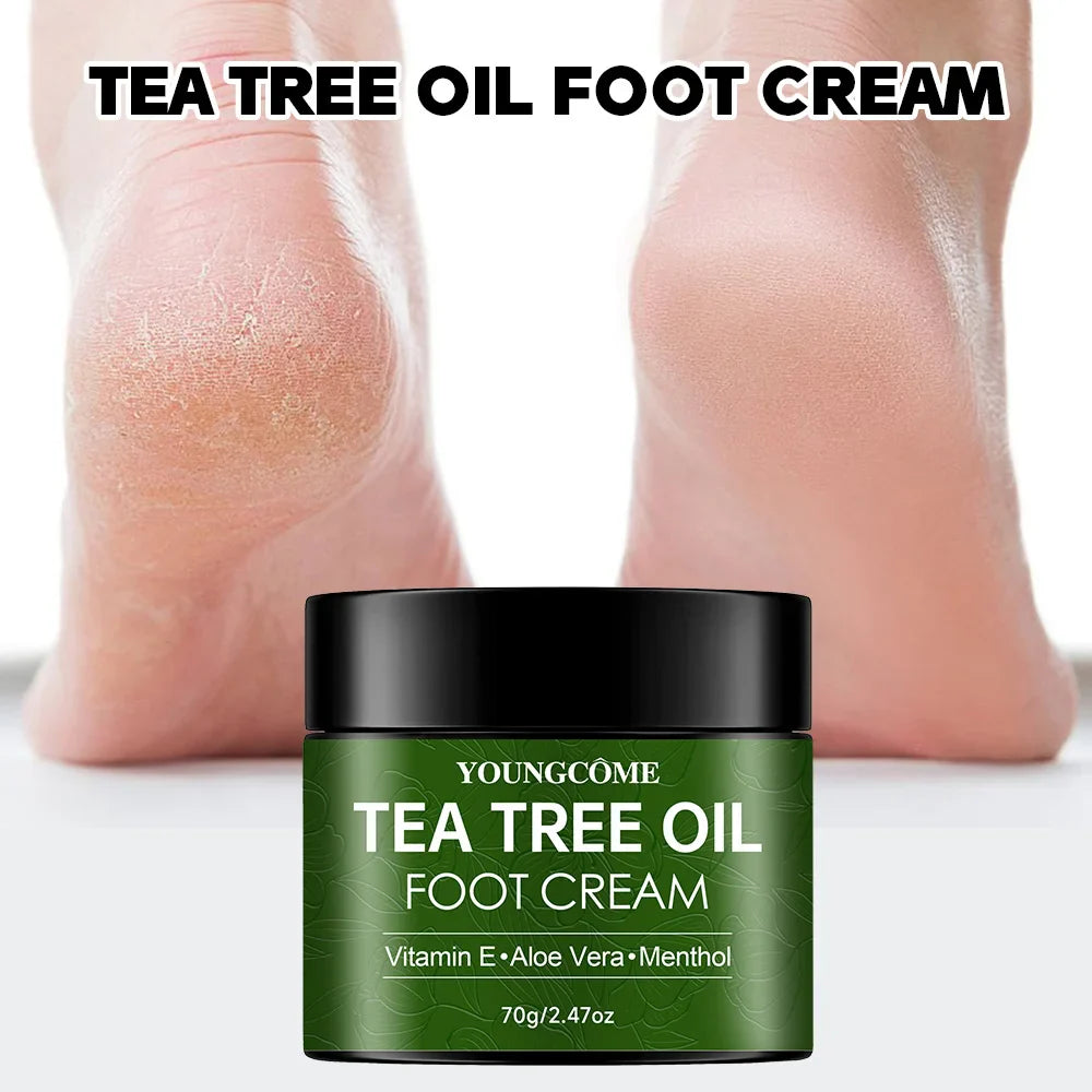 YOUNGCOME Tea Tree Foot Cream – Soften & Hydrate Rough Heels