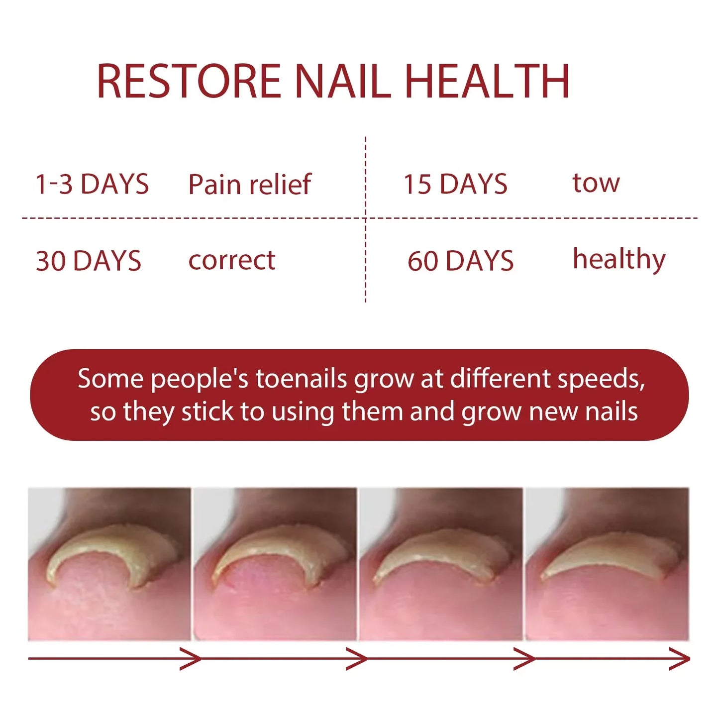 Fungal Nail Treatment Serum Foot Nail Fungus Removal Repair Gel Anti Infection Paronychia Onychomycosis Foot Nails Care Essence Peaceful Pleasures Health and Wellness