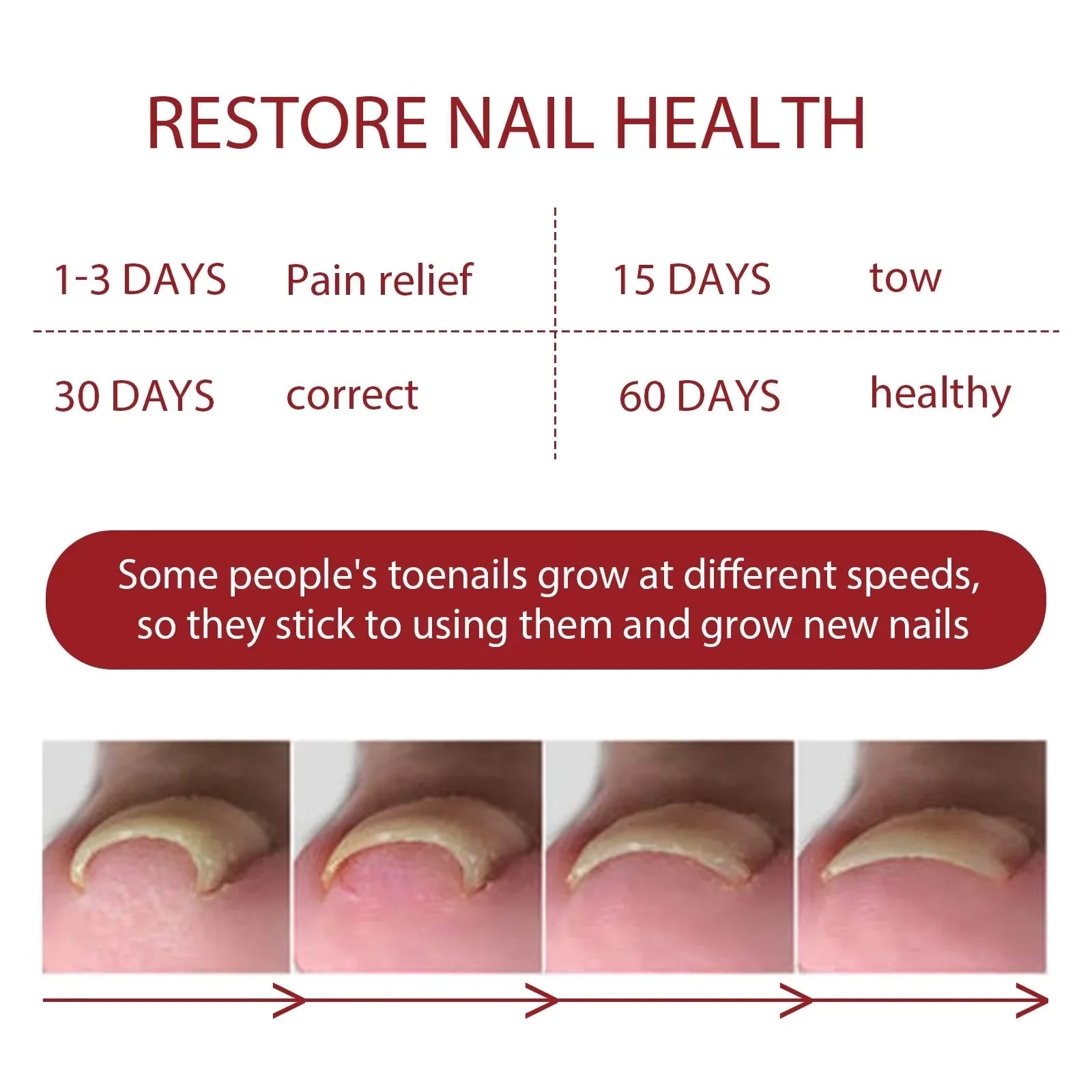 Fungal Nail Treatment Serum Foot Nail Fungus Removal Repair Gel Anti Infection Paronychia Onychomycosis Foot Nails Care Essence Peaceful Pleasures Health and Wellness