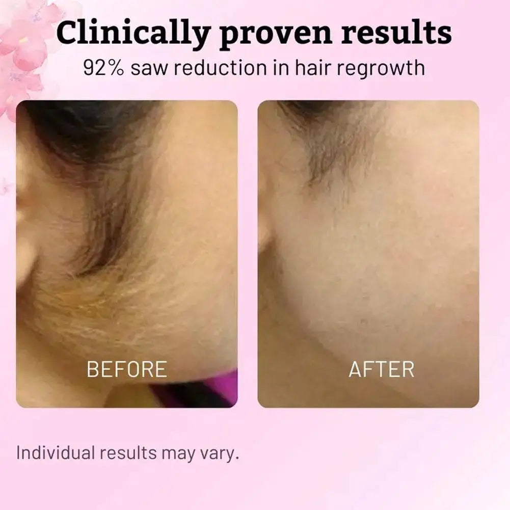 After Hair Removal Serum | Cyperus Oil Smooth Skin Care 60ml
