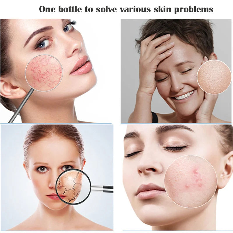 EXWIDO Hyaluronic Acid & Collagen Anti-Aging Face Serum 250ml