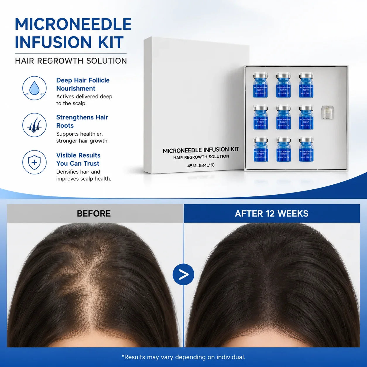 Microneedle Hair Growth Kit – Scalp Serum & Needle Head 9×5ml
