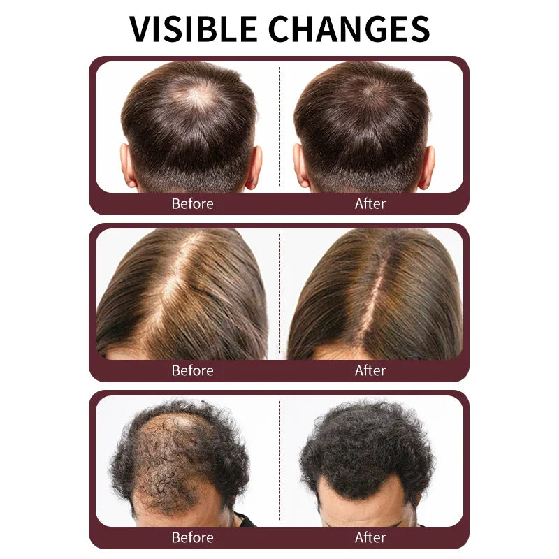 Batana Oil Shampoo for Hair Growth & Hair Loss Reduction