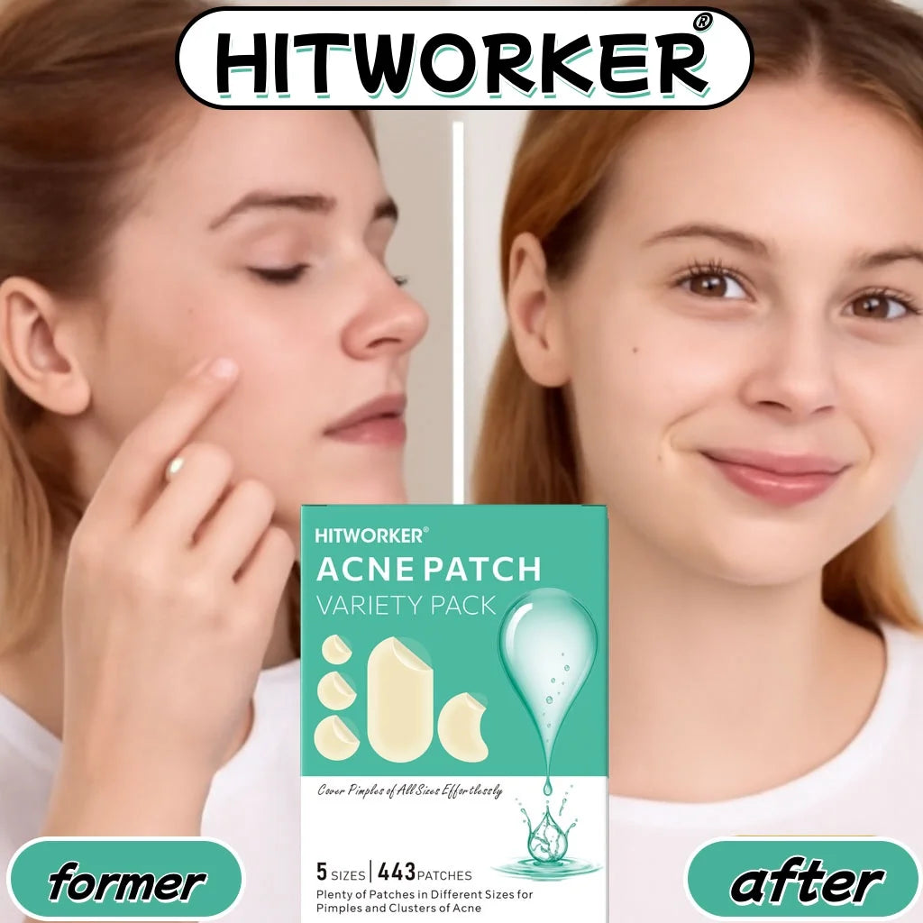 Hydrocolloid Acne Patches – Invisible, Waterproof | All Skin Types