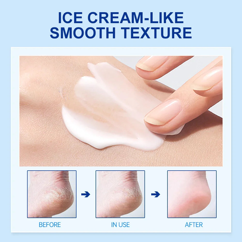 JoyPrettyin 42% Urea Foot Cream – Exfoliating & Moisturizing