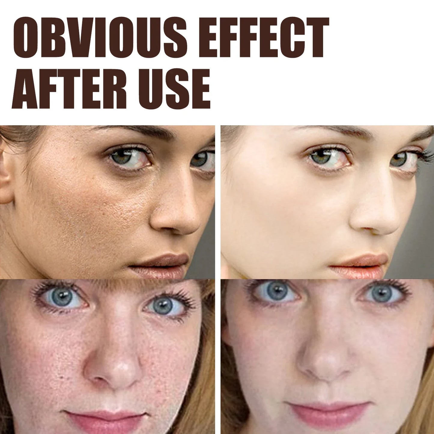 Eelhoe Double Retinol Face Cream – Anti-Aging & Brightening