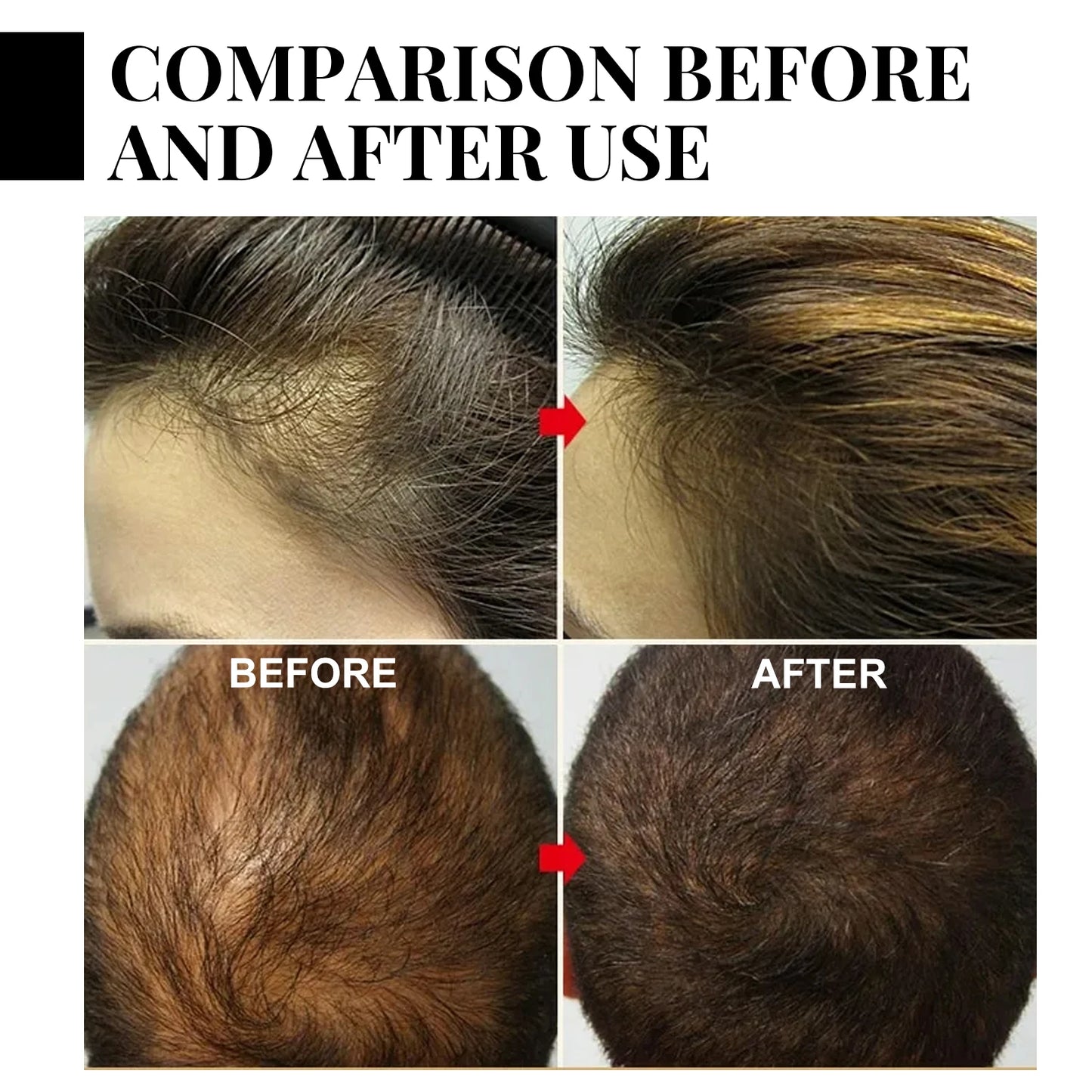 Batana Oil Hair Growth Spray for Men & Women – 30ml
