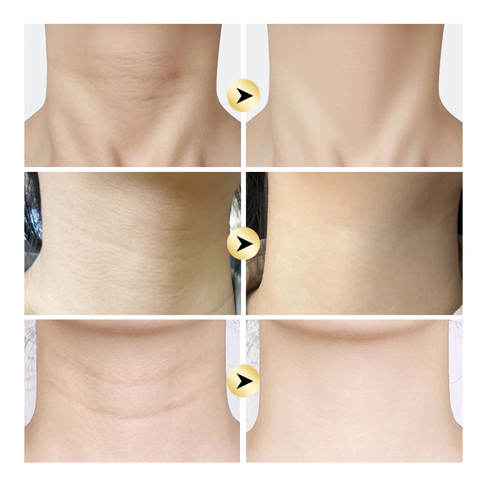 AH-8 Firming Lifting Neck Cream Deep Moisturizing Firms Neck Loose Skin Roller Design Smooth Fine Lines Wrinkles Neck Cream Peaceful Pleasures Health and Wellness