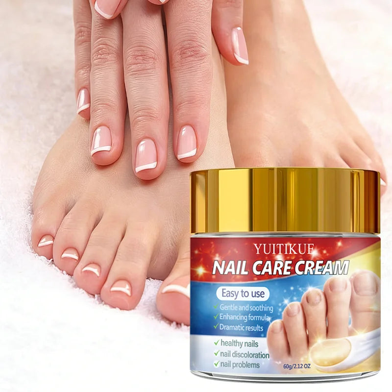 Yuitikue Nail Care Cream, 60g Gentle Nail Repair Cream for Nail Discoloration & Nail Problems, Promoting Healthy Nails Peaceful Pleasures Health and Wellness