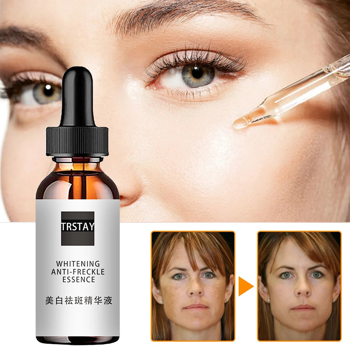 Niacinamide Acid Facial Essences Deep Moisturizing Niacinamide Acid Face Serums Niacinamide Facial Toner Essence Shrink Pores Peaceful Pleasures Health and Wellness 5ml