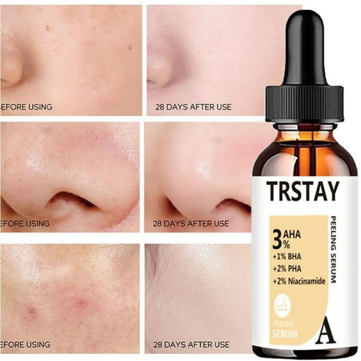 AHA Peeling Serum Salicylic Acid Face Essence Shrink Pores Acne Treatment Removal Blackhead Melasma Whitening Facial Skin Care Peaceful Pleasures Health and Wellness