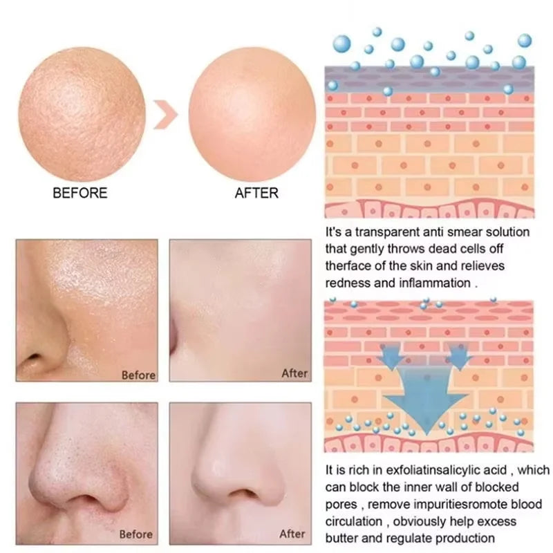 Pore Minimizing Face Serum – Oil Control & Blackhead Care