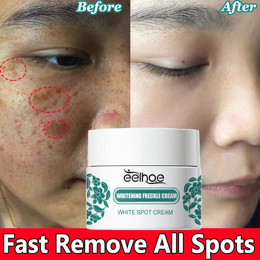 Eelhoe Vitamin C Face Cream – Dark Spot & Brightening Corrector Brightening Face Cream Oasis Select Default Title