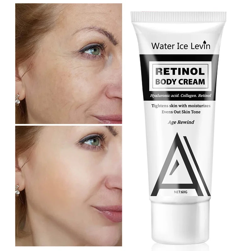 Retinol Body Lotion – Firming Moisturizer for Face & Dry Skin Retinol Body Lotion Peaceful Pleasures Health and Wellness