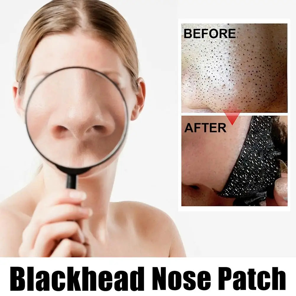 Blackhead Remover Nose Strips – Deep Pore Cleansing Nasal Patches for Blackhead & Acne Treatment 10pcs Peaceful Pleasures Health and Wellness