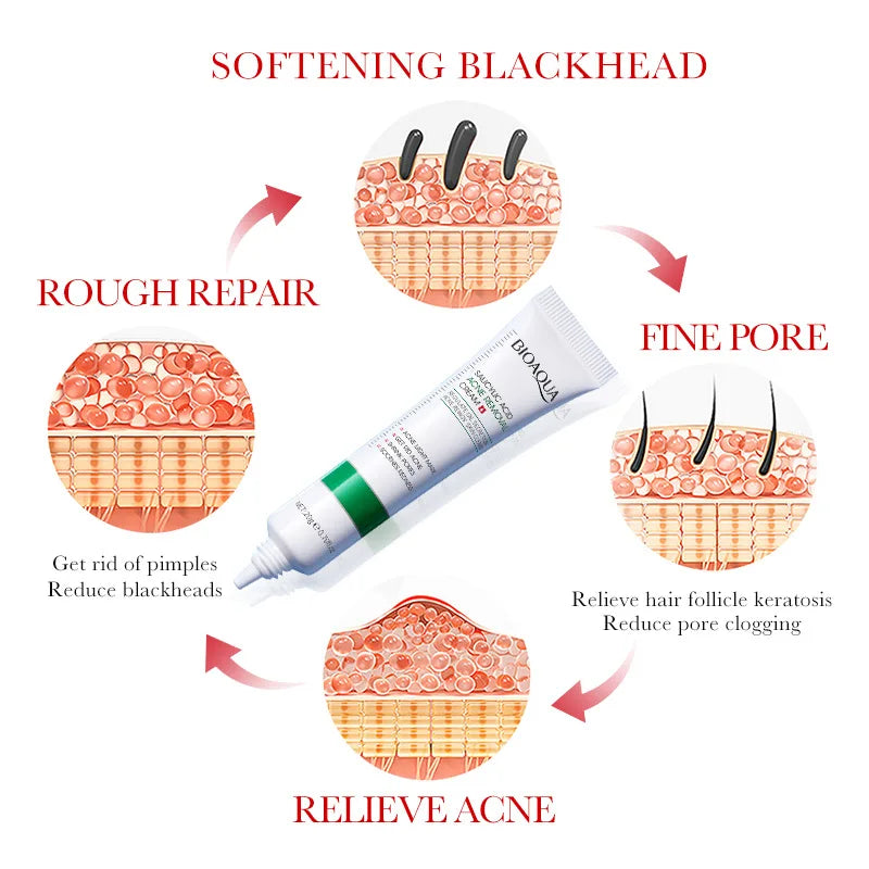 BIOAQUA Salicylic Acid Face Cream – Acne & Blackhead Remover
