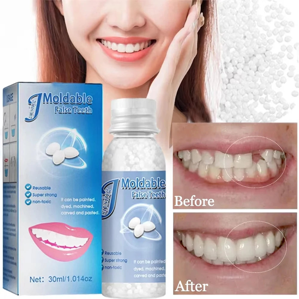 Temporary Tooth Repair Kit | DIY Moldable Filling & Gap Fix